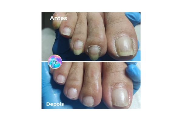 Foto de antes e depois do tratamento 19